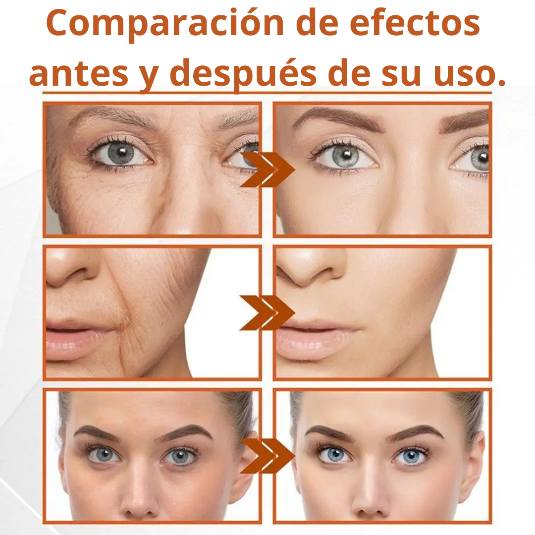 Kit Colágeno Hidrolizado con VIT C